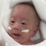 وزنه عند الولادة 268 جراما.. ولادة ثانى أصغر طفل رضيع فى العالم